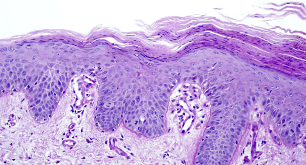 Microscopic view of skin tissue layers.