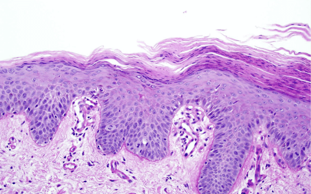 Microscopic view of human skin tissue.